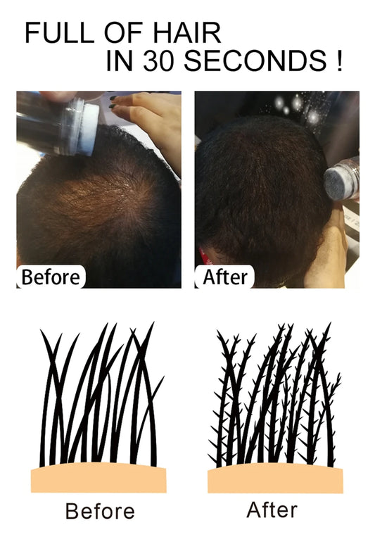 10 Colors Sevich Hair Fibers Keratin Fibers Applicator Hair Building Fibers Spray Hair Loss Instant Regrowth Thickening Powders