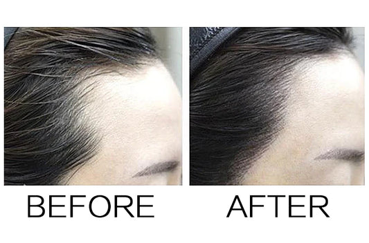 Sevich 8 color Hair Shadow Powder Repair Hair Shadow Hair line Modified Hair Concealer Natural Cover Instant Hair Fluffy Powder