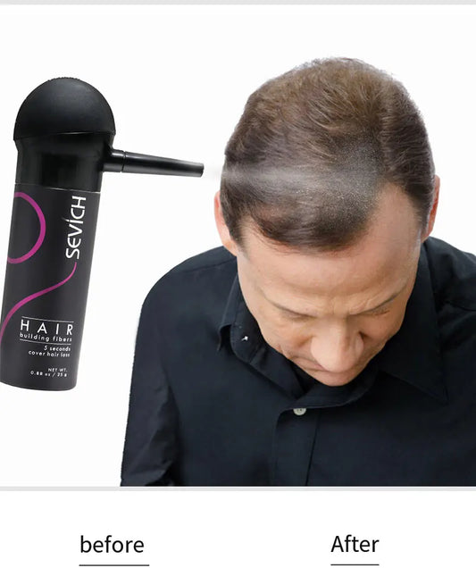 Sevich Hair Building Fiber Applicator Apply to Brand Fiber Bottle Series Easy to Use Hair Sprays Nozzle Pump Hair Loss Product